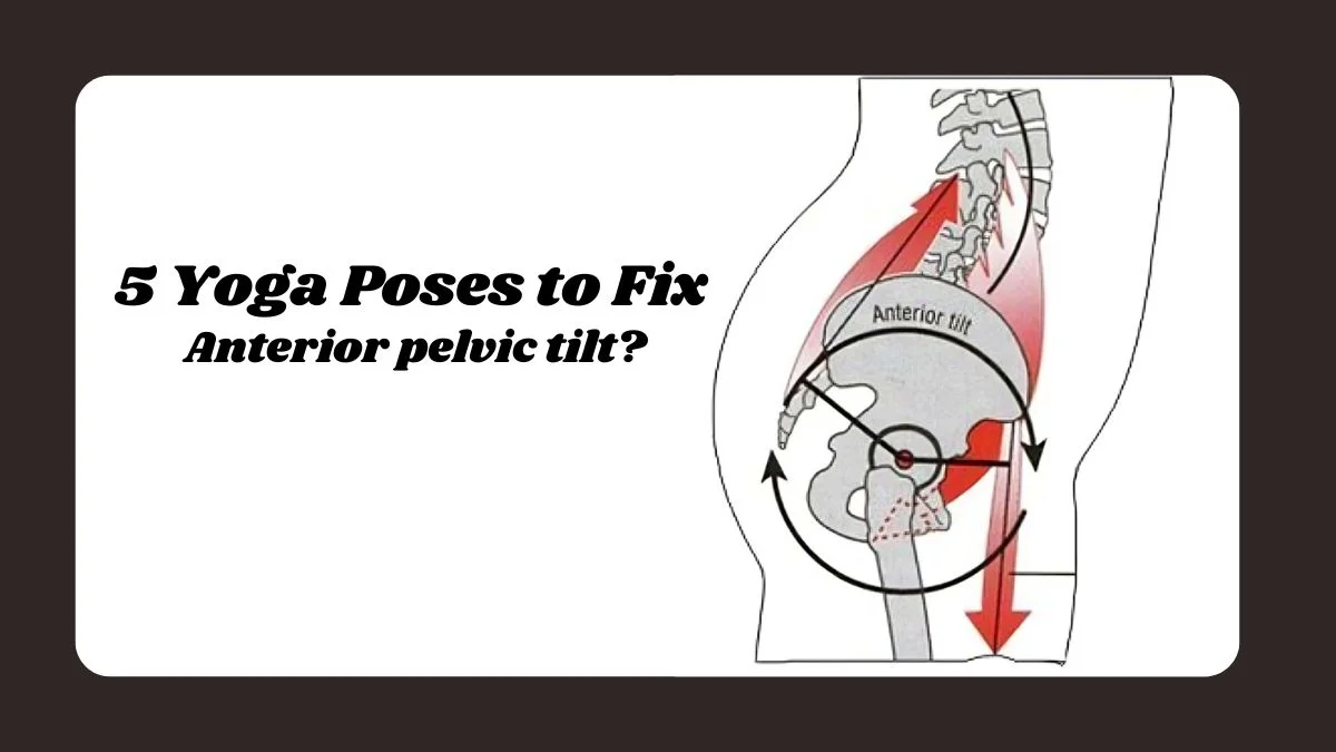 Anterior Pelvic Tilt