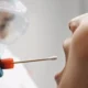 Cheek Swab Test