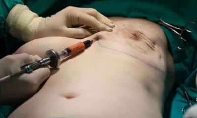 Breast Surgery