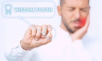 Wisdom Teeth Removal: When, Why, and What to Expect