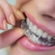 The Role of Invisalign in Correcting Bite Issues and Jaw Health