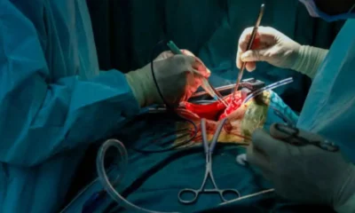 Impact of Whipple Surgery on Long-Term Quality of Life