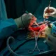 Impact of Whipple Surgery on Long-Term Quality of Life