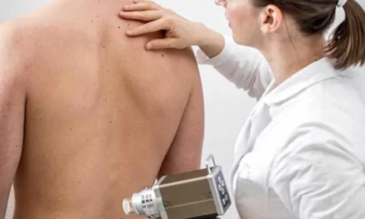 Why Young Adults in Western Australia Are Booking Mole Mapping Early