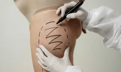 How Long Do Results Last? Nashville’s Top Cellulite Treatments Explained
