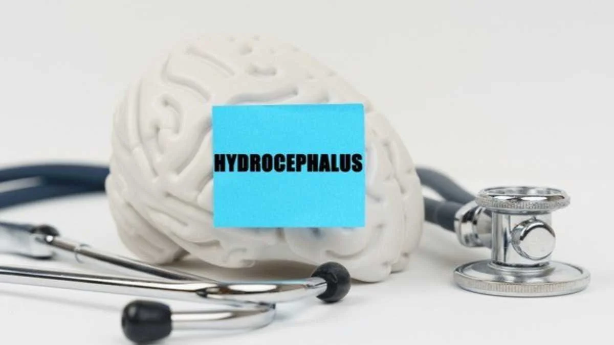 What is Hydrocephalus, and How is it Categorized?