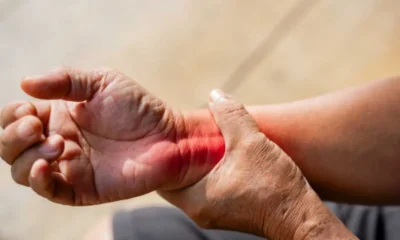 Experiencing Arthritis Pain? Here's How to Find Comfort