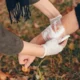 First Aid Tips to Keep in Mind That May Help After a Burn Injury