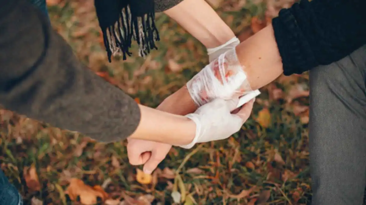 First Aid Tips to Keep in Mind That May Help After a Burn Injury