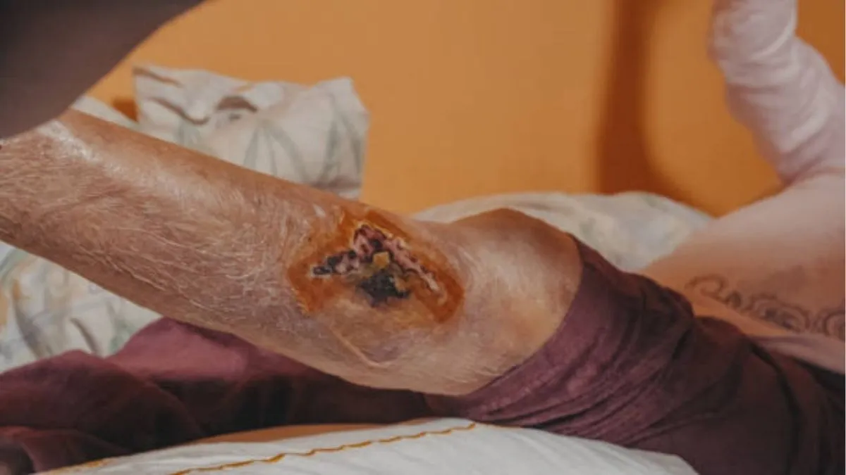 How Vascular Issues Affect Wound Healing: What Patients Need to Know