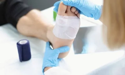 How Specialists Determine the Severity of a Chronic Foot Wound?