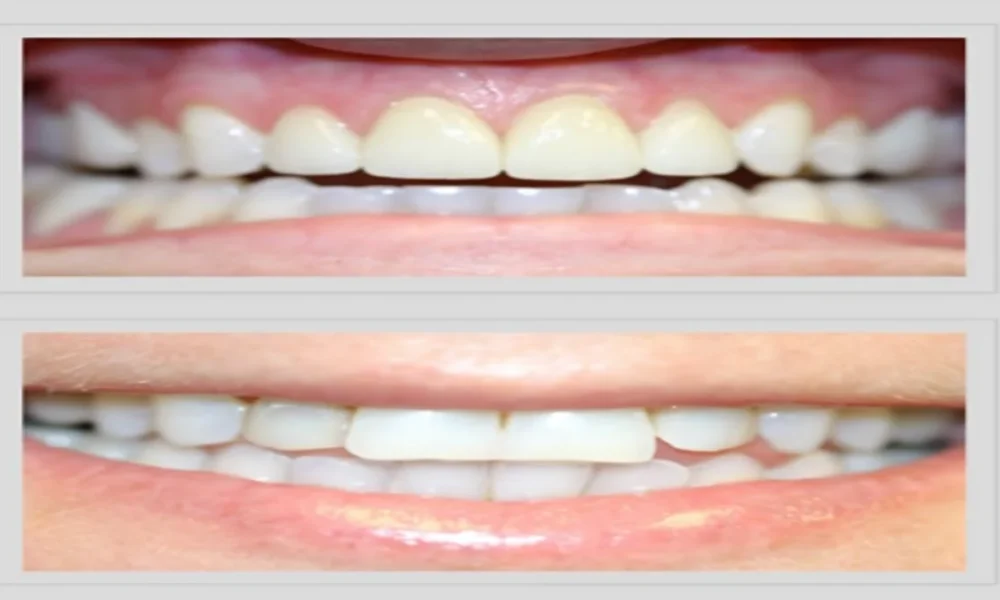 Why Cosmetic Dentistry at Ocean Hills Dentistry Delivers a Natural, Boutique-Quality Smile