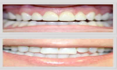 Why Cosmetic Dentistry at Ocean Hills Dentistry Delivers a Natural, Boutique-Quality Smile
