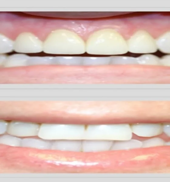 Why Cosmetic Dentistry at Ocean Hills Dentistry Delivers a Natural, Boutique-Quality Smile