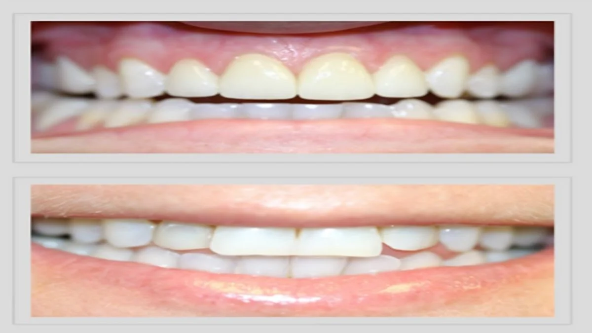 Why Cosmetic Dentistry at Ocean Hills Dentistry Delivers a Natural, Boutique-Quality Smile