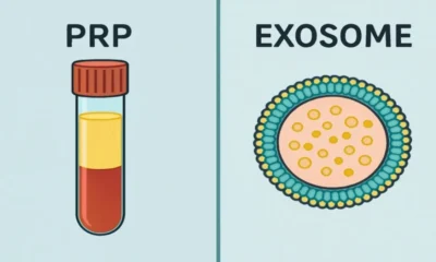 Exosomes vs PRP: A Comprehensive Comparison in Regenerative Medicine
