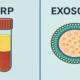 Exosomes vs PRP: A Comprehensive Comparison in Regenerative Medicine