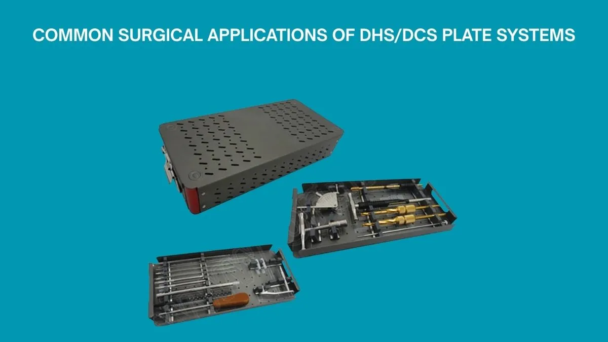 Common Surgical Applications of DHS/DCS Plate Systems