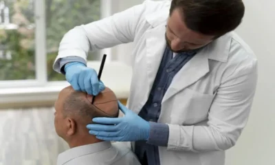 How Much Does Hair Transplant Cost in UAE
