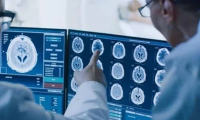 Why Second Reads Matter For Complex Or Rare Cases