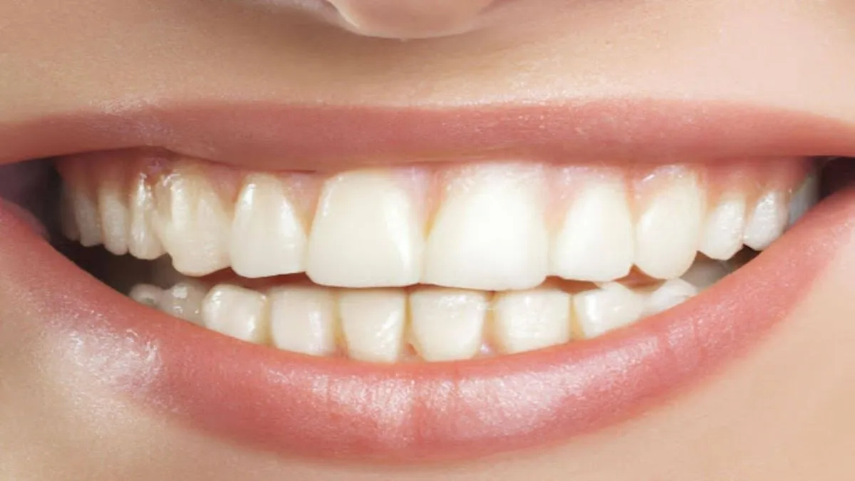 Professional and At-Home Teeth Whitening: Key Differences Explained