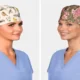 Why More Women in Healthcare Are Choosing Ponytail Scrub Caps