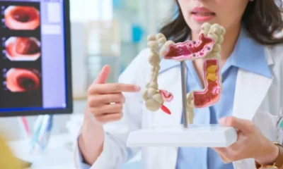Colonoscopy and Colorectal Health Awareness in Singapore