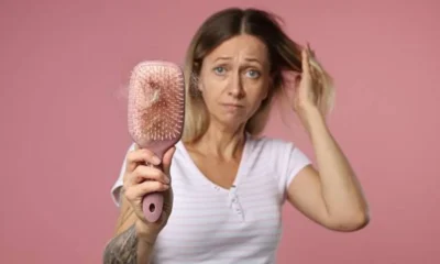 Does Stress Cause Hair Loss