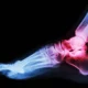 Preparing for Foot and Ankle Surgery: What Patients in Singapore May Need to Know