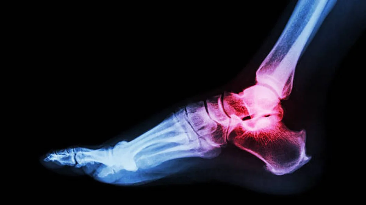 Preparing for Foot and Ankle Surgery: What Patients in Singapore May Need to Know