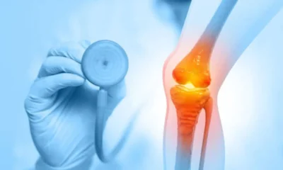 Knee Specialist in Singapore: When to Book an Appointment