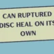 Can Ruptured Disc Heal on Its Own