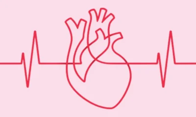 What Is an Arrhythmia and When Is It a Concern?