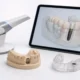 Digital Implant Workflows in 2026: A Practical Guide from Scan to Smile