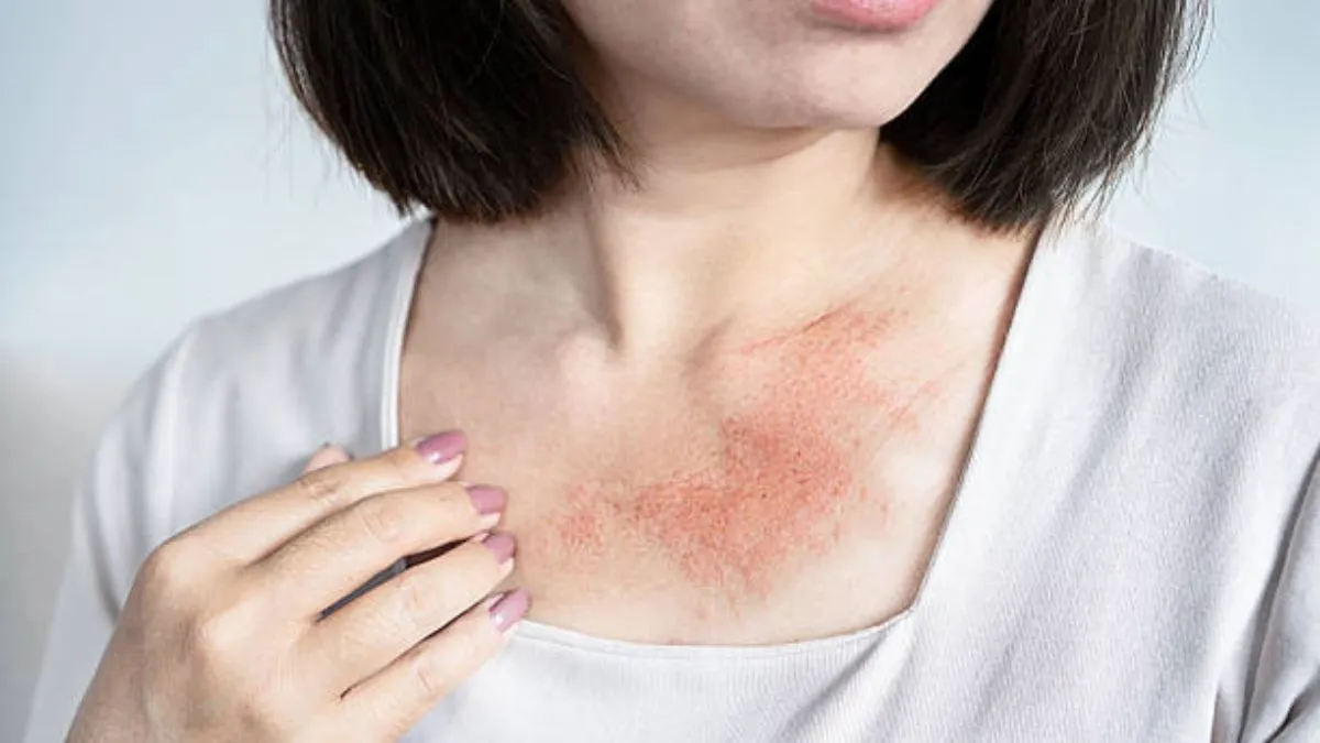 How Dermatologists Treat Chronic Skin Conditions