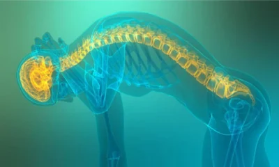 Spinal Decompression at Home: What It Actually Does and Who It's For