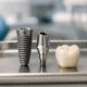 Top 7 Dental Implant Providers in Maple Grove and Brooklyn Park