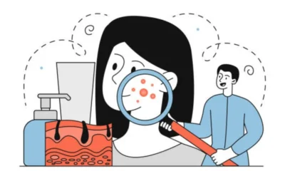 Dermatologist: Why This Specialist Matters for Your Skin Health