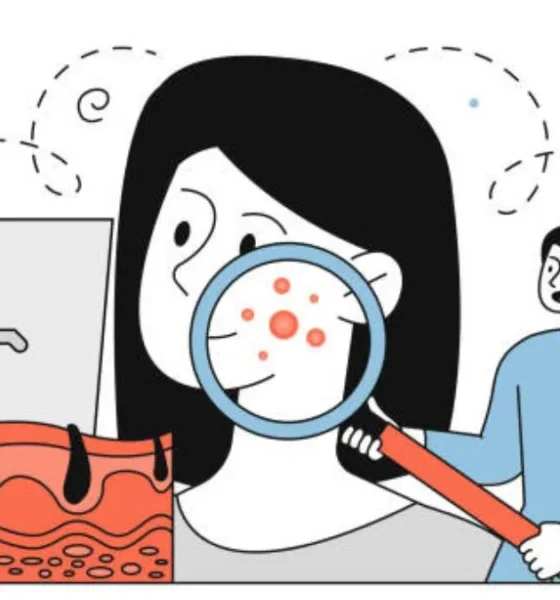 Dermatologist: Why This Specialist Matters for Your Skin Health